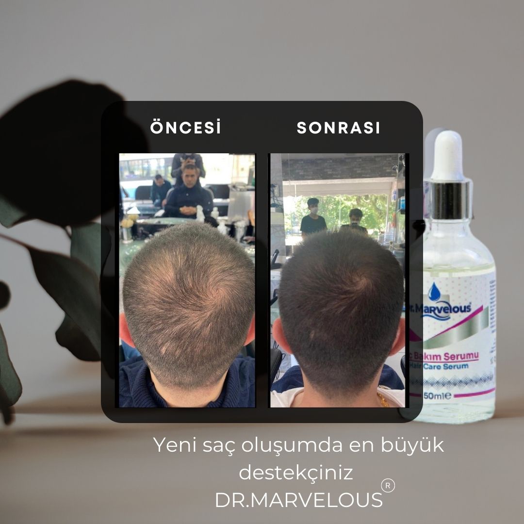 Doğal Saç Serumu 50ml